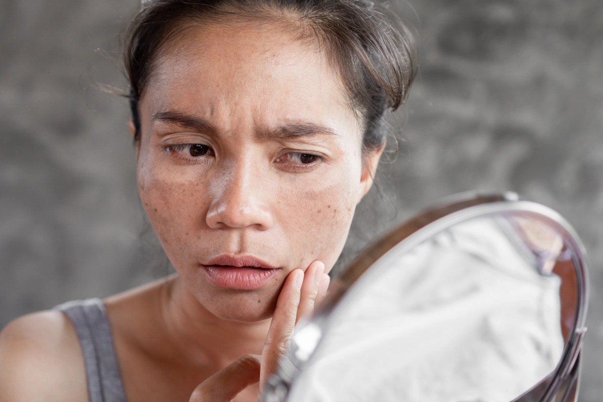 congested skin