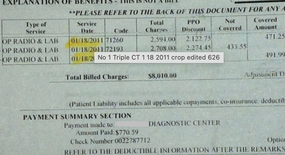 How much does a CT scan cost? $930 or $8,010 or $267 