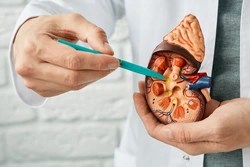 Kidney Cancer Prevention