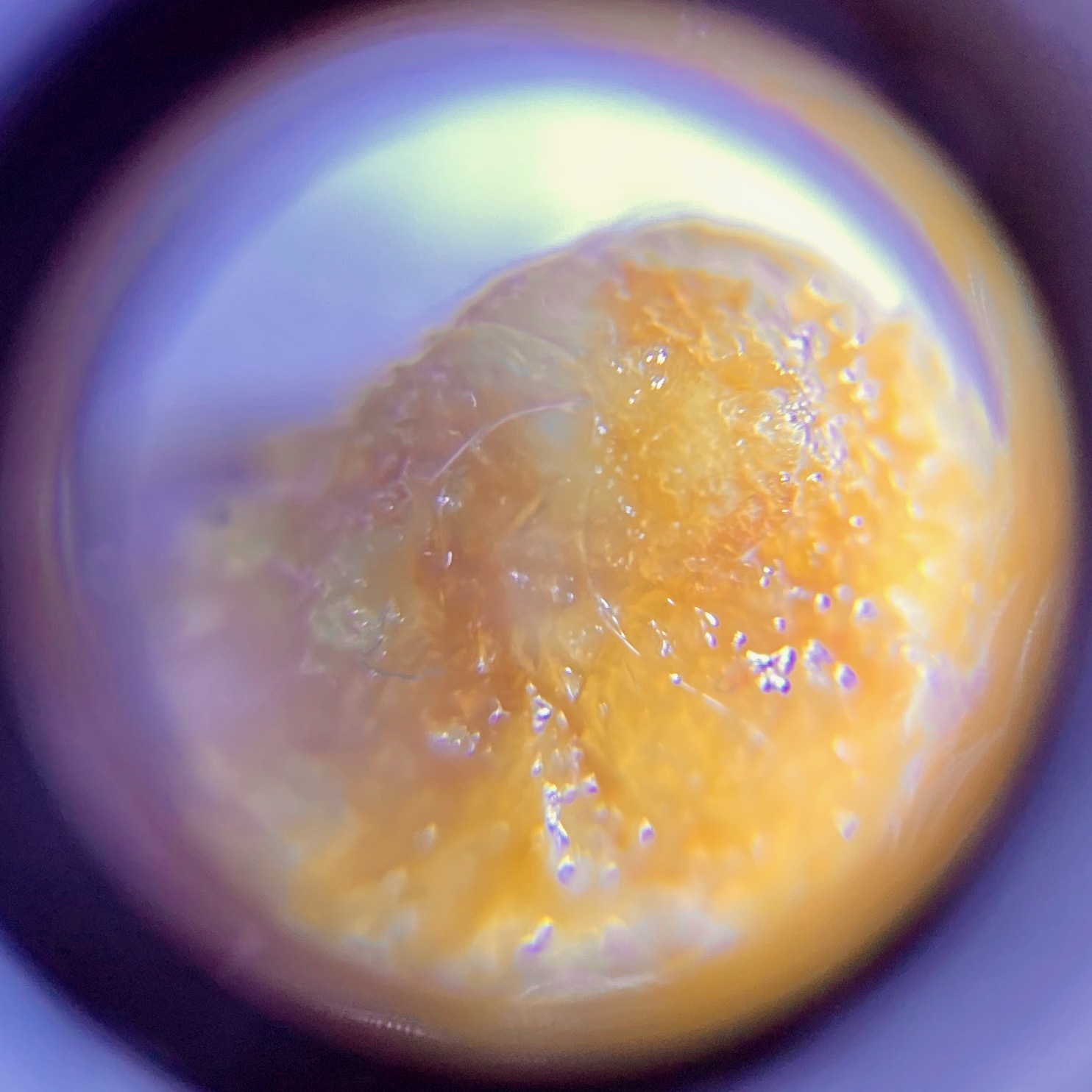 Sous/under microscope