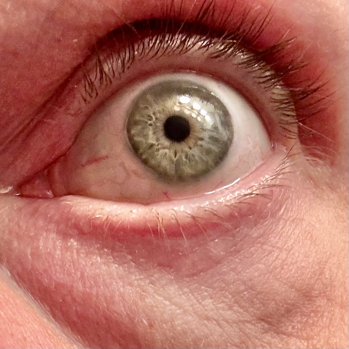 Pupille contractée / Oeil (myosis) - 2024/02/03