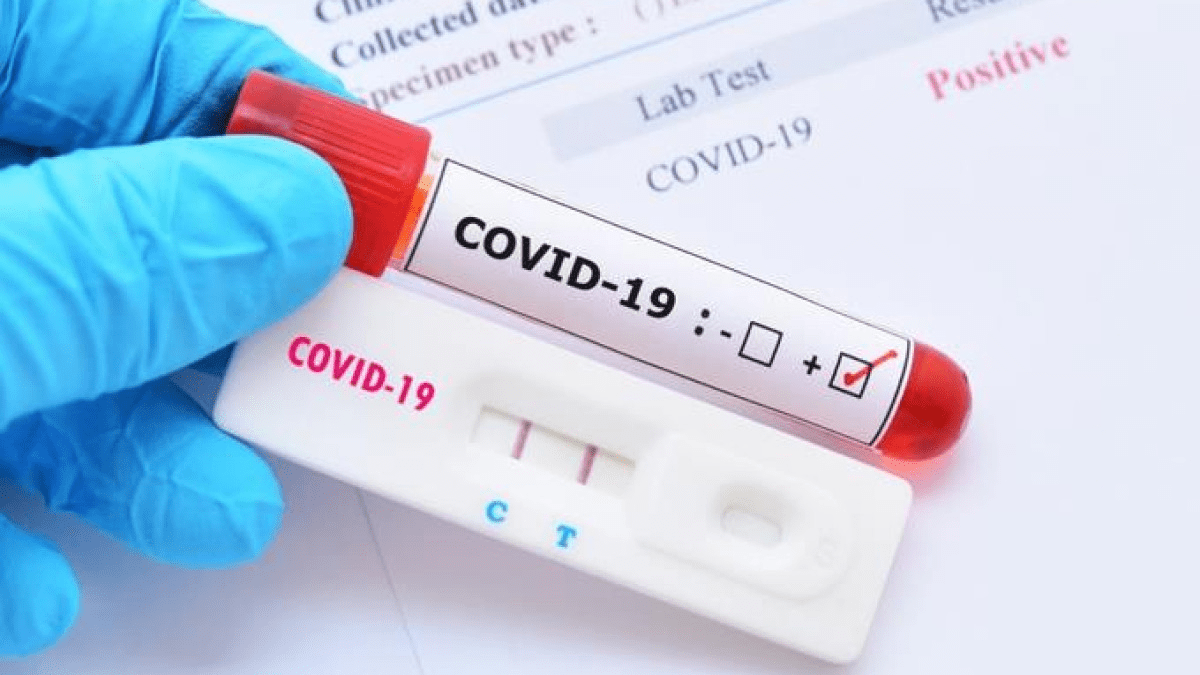 Salud registra nueve casos de Covid-19 en la última semana y mantiene vigilancia epidemiológica