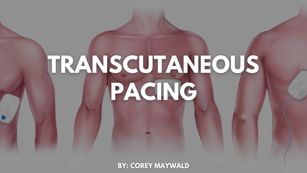 Transcutaneous Pacing