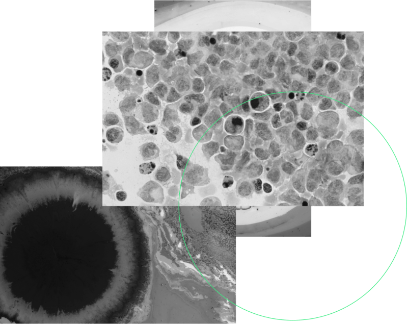 Commit Biologics On Linkedin Complementsystem Immuneresponse - Best Landscape Images in HD