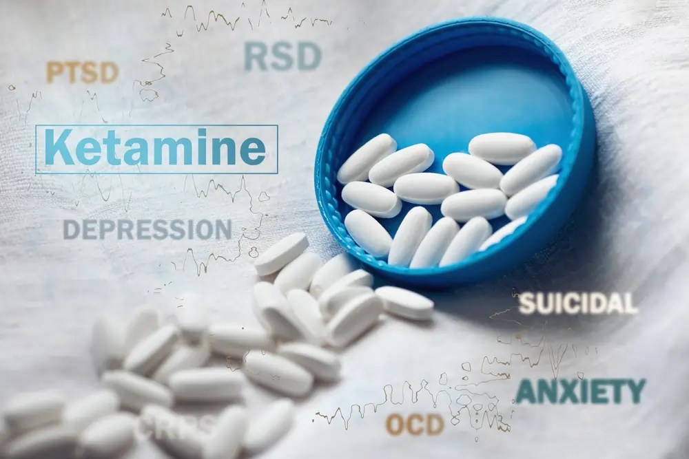Benefits of Ketamine for Anxiety: How Ketamine‑Assisted Psychotherapy Offers New Options in NYC 1 Does Ketamine Reduce Anxiety