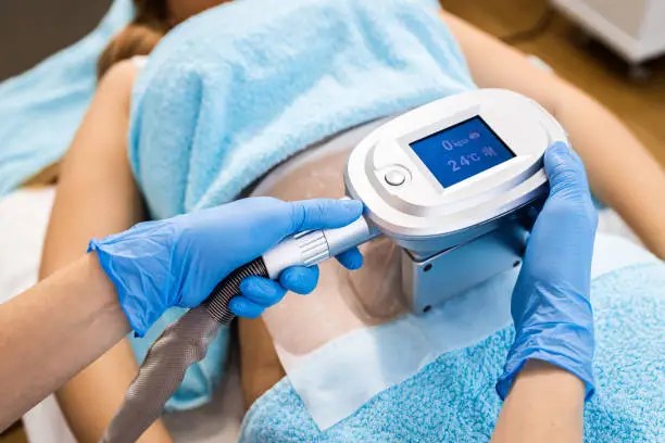 Différences entre lipocavitation et cryolipolyse