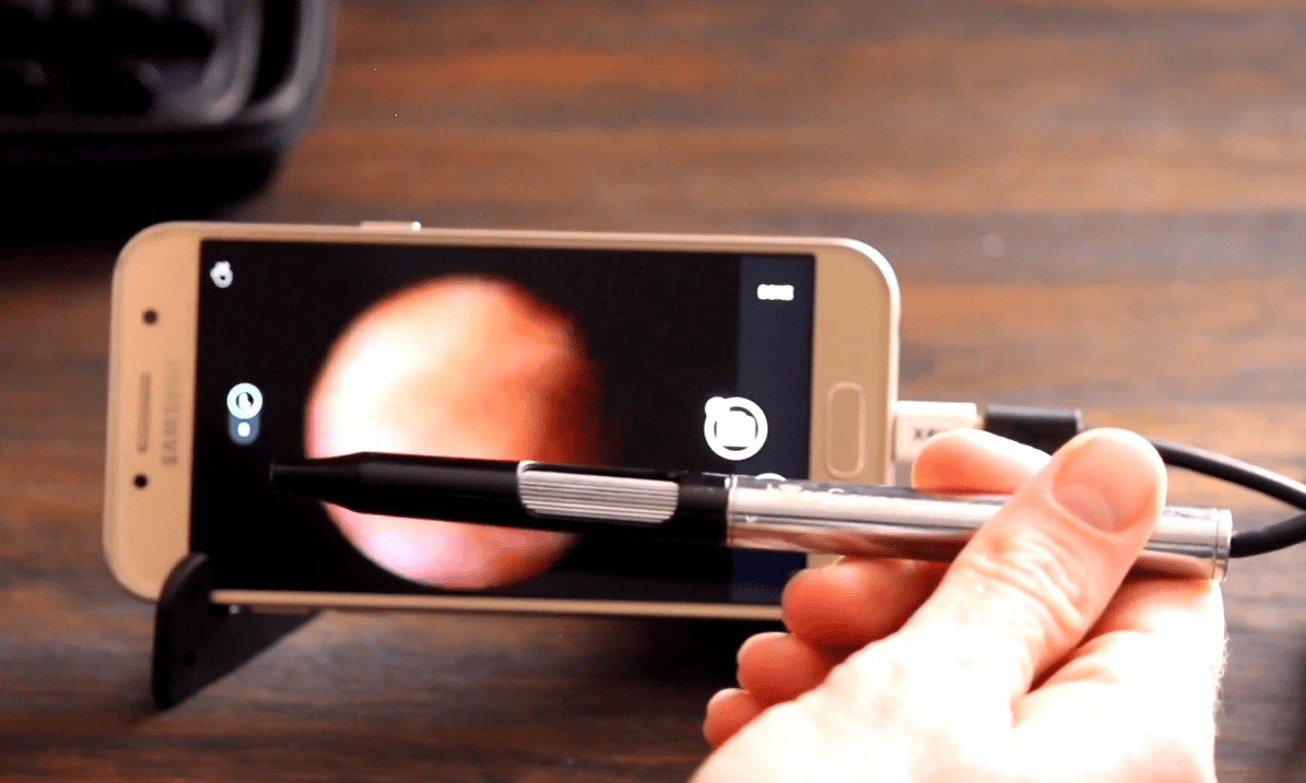 Read more about the article AI-assisted Diagnosis for Middle Ear Pathologies