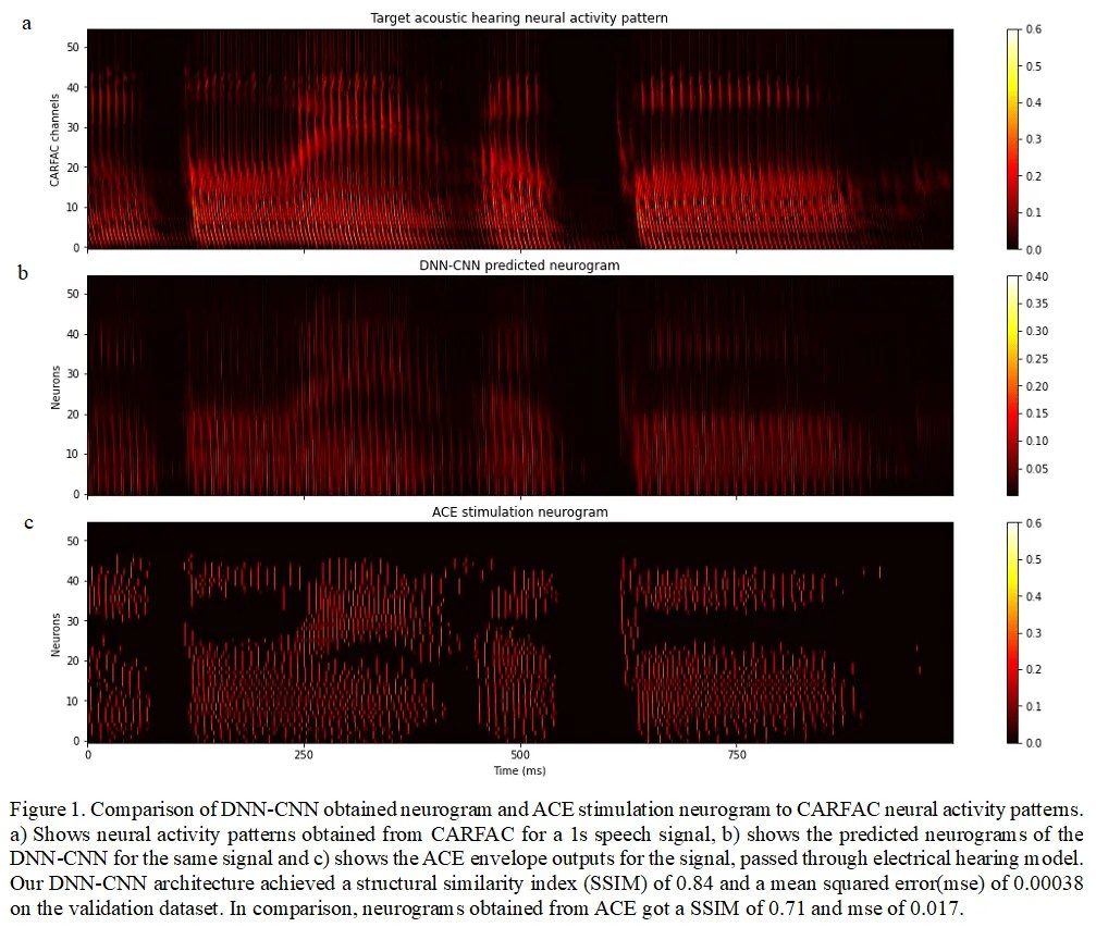 Read more about the article Developing novel electrical stimulation strategies for cochlear implant users based on a model of the healthy human cochlea