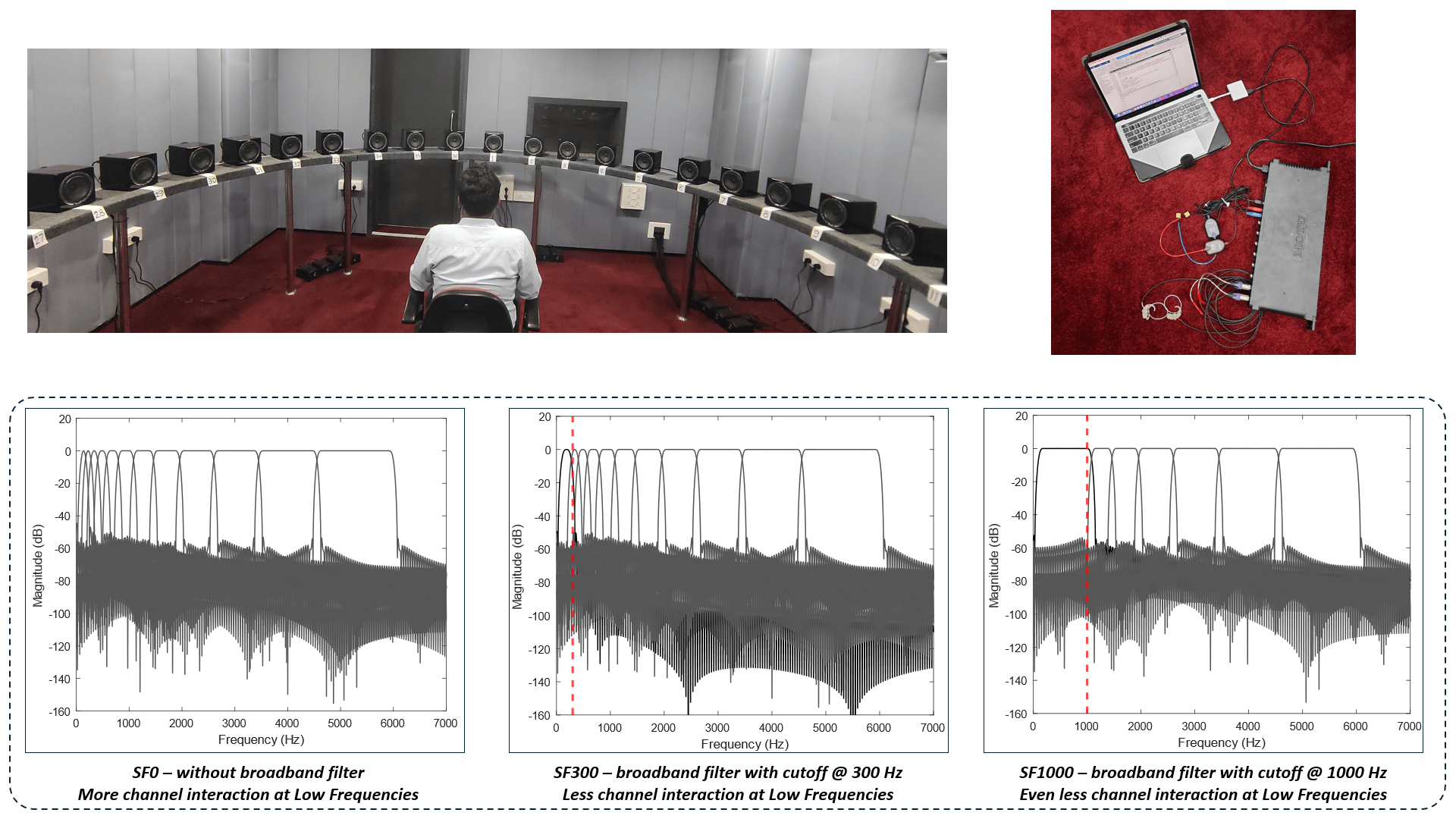 Read more about the article Effect Of Broadband Gain Frequency Shaping On Horizontal Localization Performance In Individuals With Normal Hearing