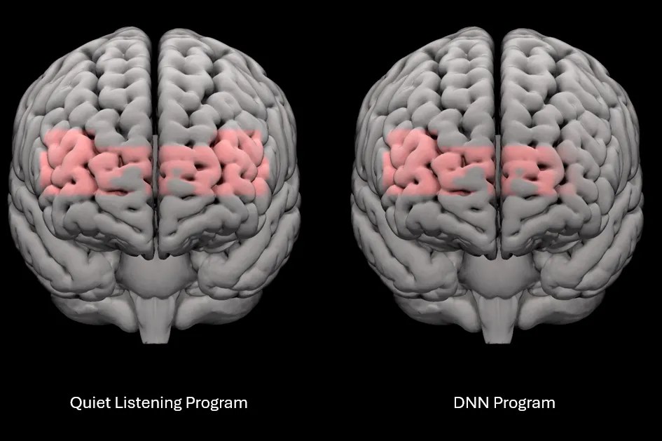 Read more about the article Cortical benefits of DNN-based noise management in experienced hearing aid users measured using functional near infrared spectroscopy (fNIRS)