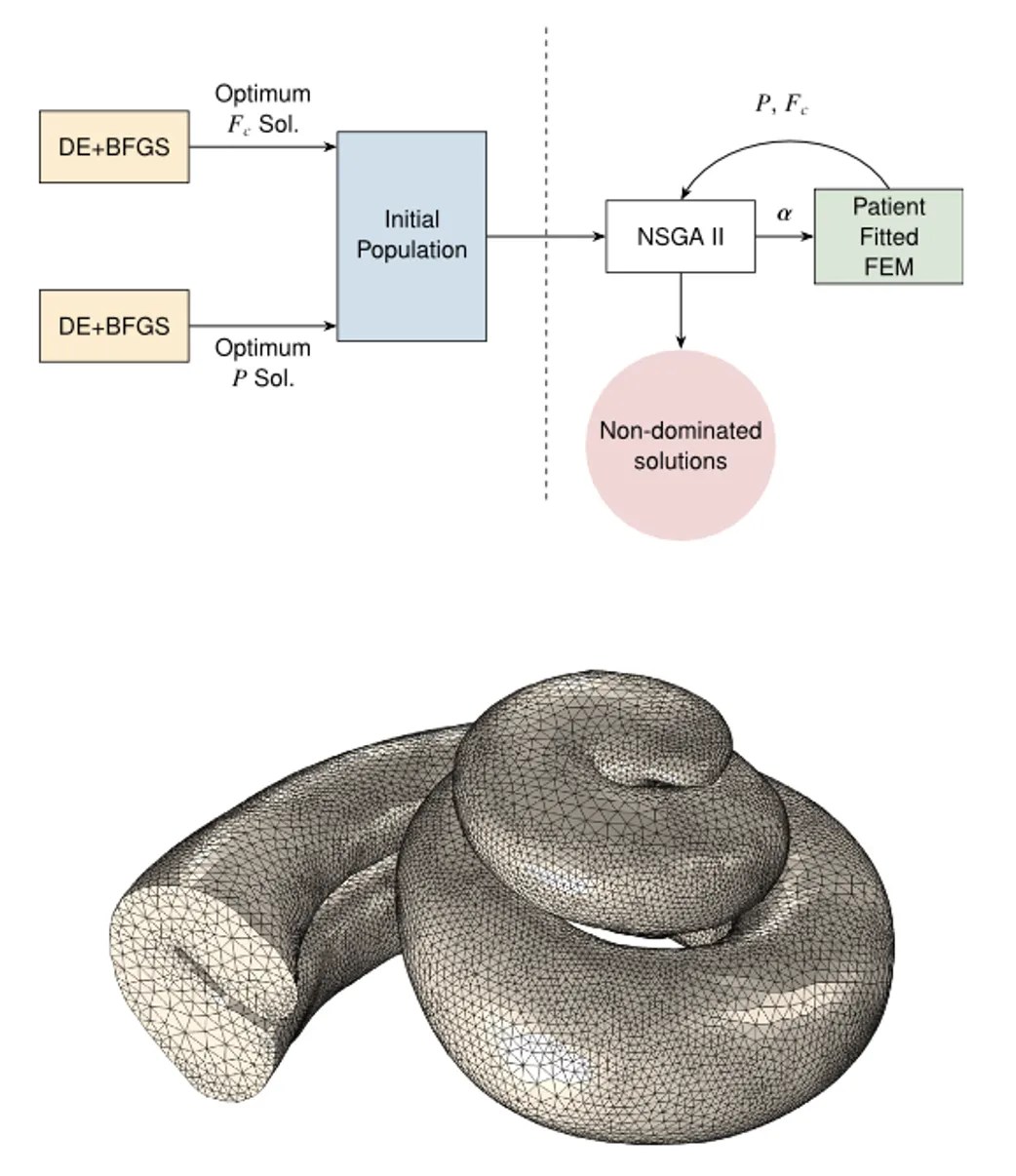 Read more about the article Finite Element Modeling, Evolutionary Optimization, and Clinical Data for Personalized Cochlear Implant Stimulation Strategies