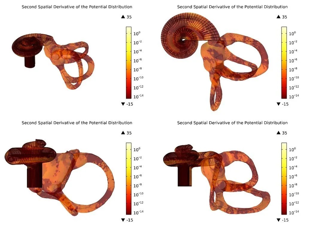 Read more about the article The Effects of Cochlear Implants on the Vestibular System 