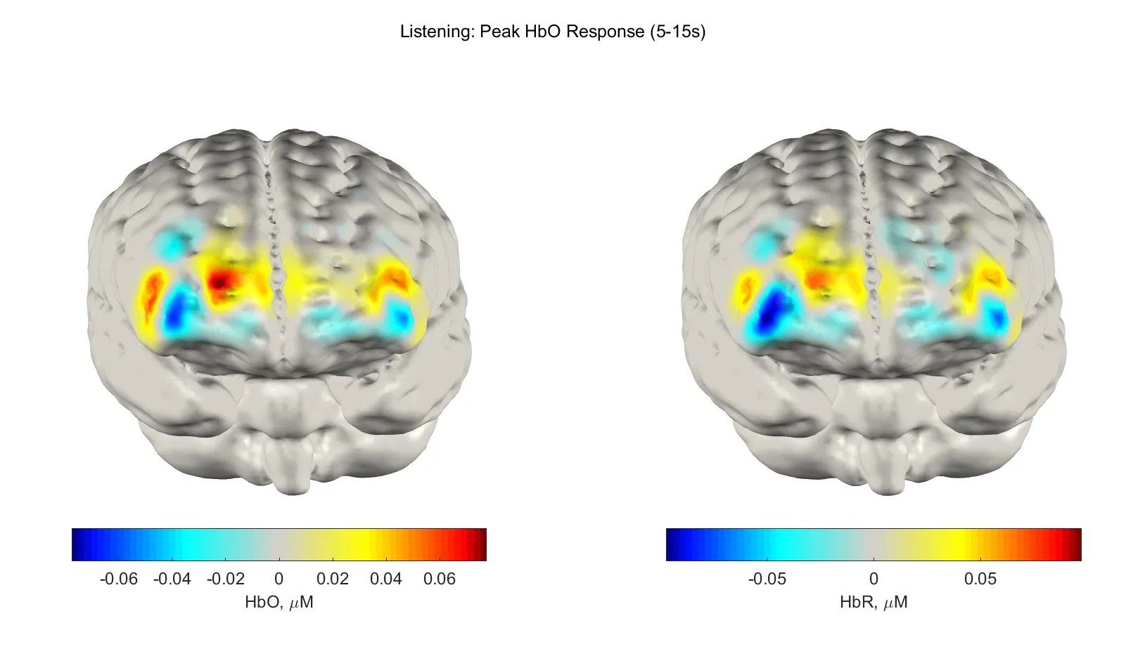 Read more about the article HD-fNIRS Assessment of Listening Effort in CycleGAN-Enhanced Virtual Acoustics 