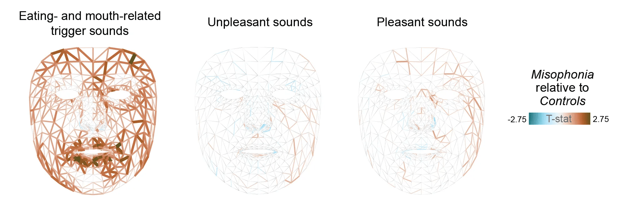 Read more about the article Triggered: using computer vision to measure sound intolerance 