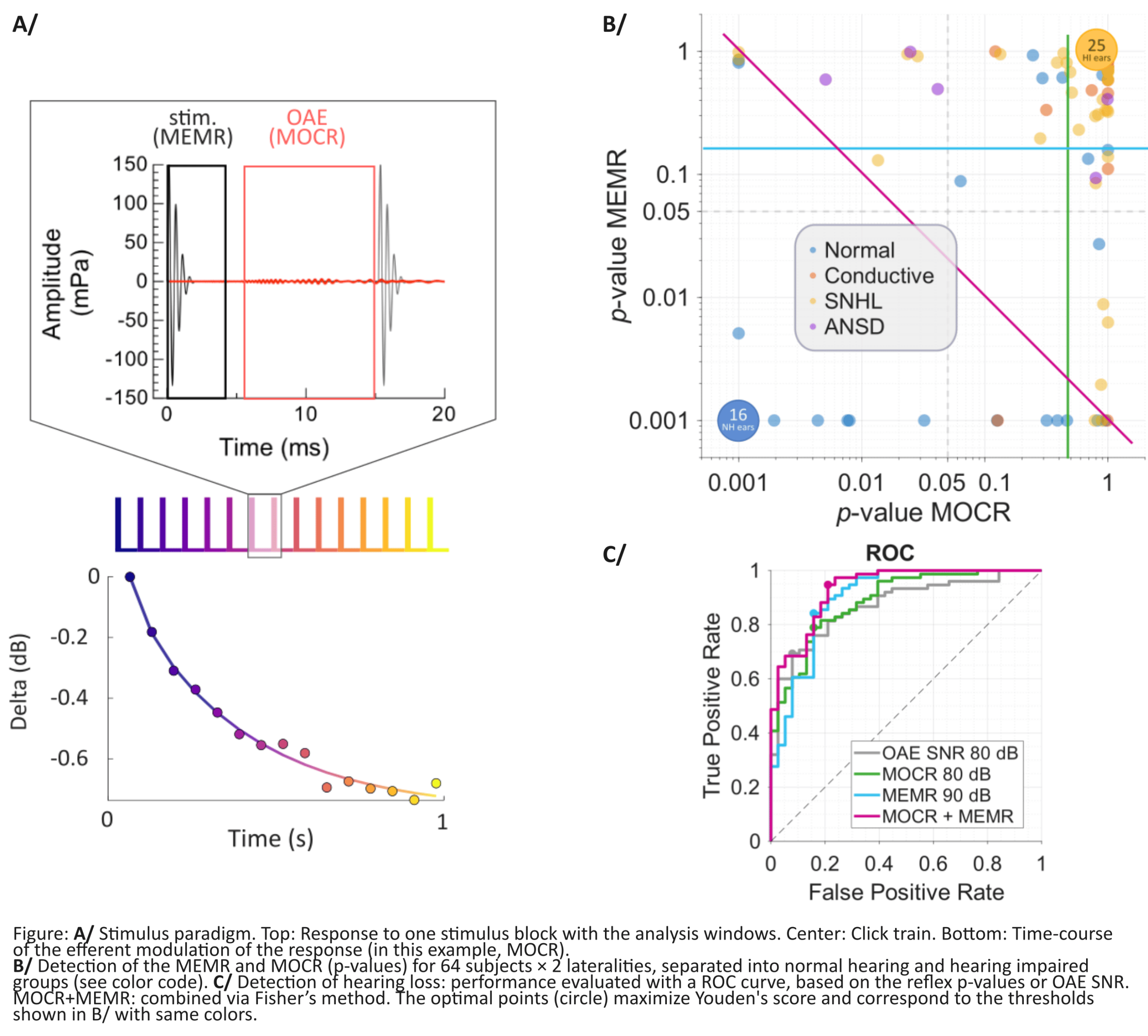 Read more about the article Otoacoustic Emission Screening Extended to the Assessment of Auditory Neural Health 
