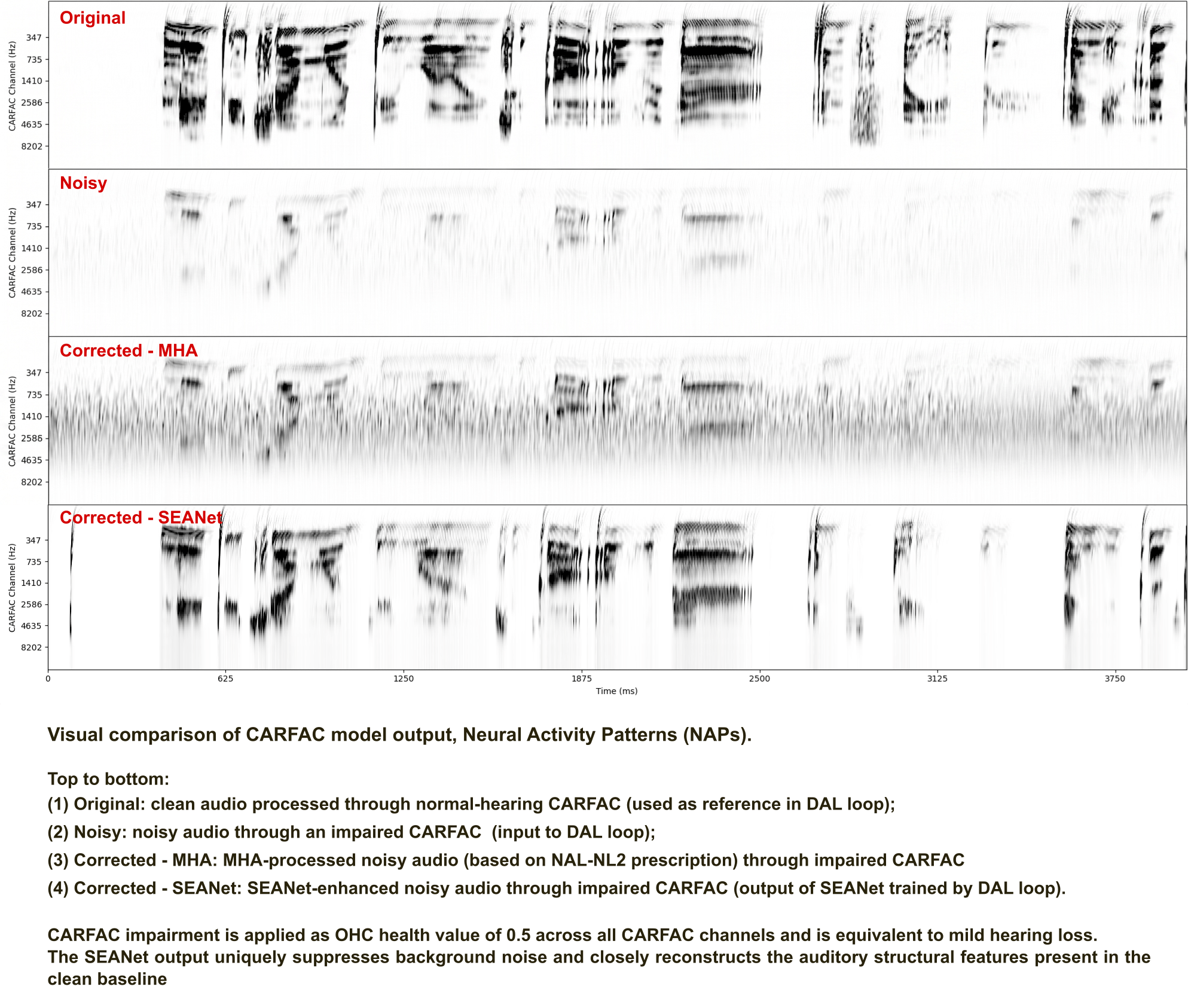 Read more about the article The Differentiable Auditory Loop (DAL): Neural Activity Alignment for Personalized Hearing Aids 