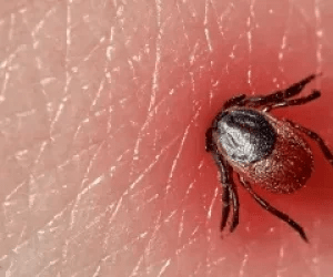 Protection from Ticks - Dentec Safety