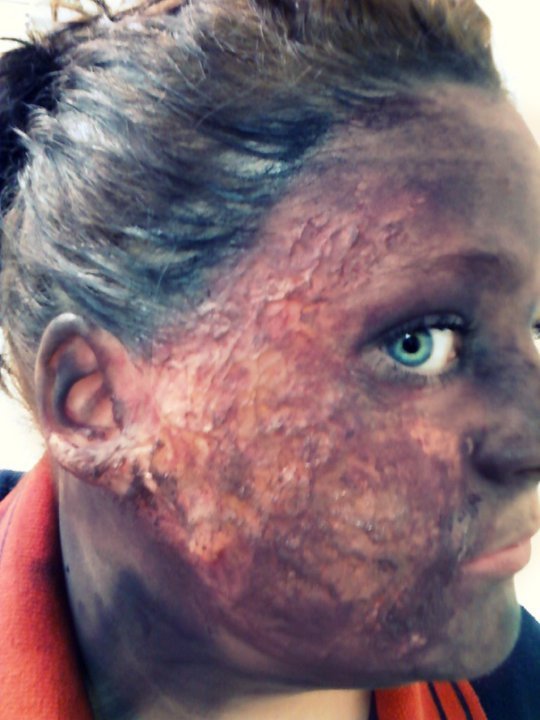 Do you see that part where the soap and oil meet? Burnt Face (with Pictures) - Instructables