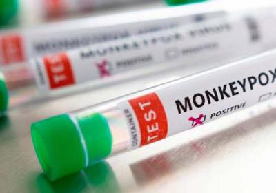 Viruela de mono llegará a Honduras y las autoridades deben estar preparadas, indica experto
