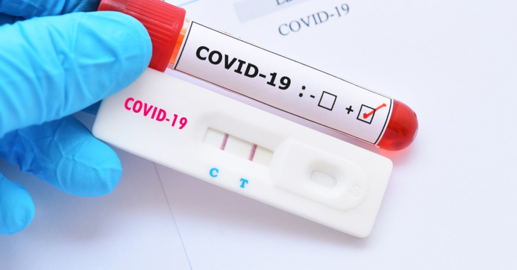 ATUALIZAÇÃO 20/10 – VAZANTE REGISTRA 6 NOVOS CASOS DE RECUPERAÇÃO DA COVID-19