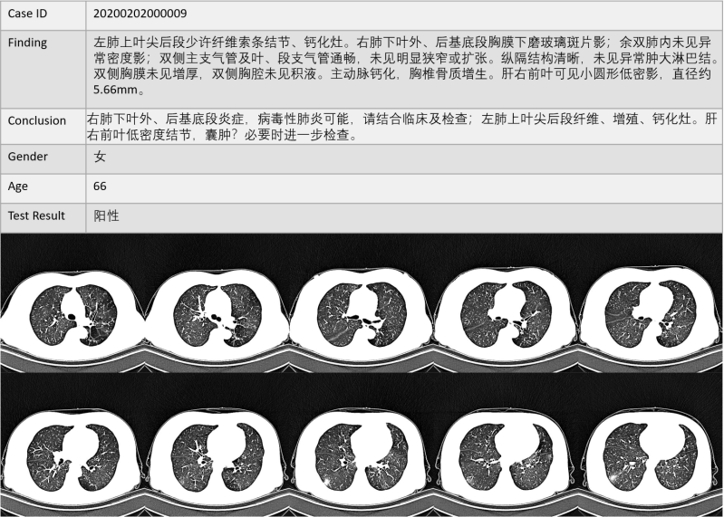 Github Emi Dm Covid Ct Dataset Covid Ct Dataset A Ct Scan Dataset - Best Abstract Designs in Ultra HD