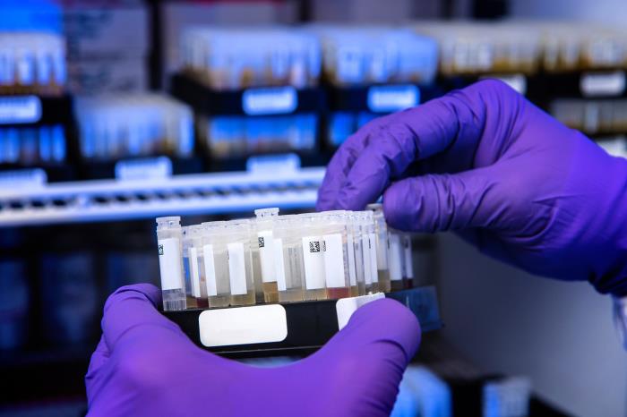 test tubes for find antibodies