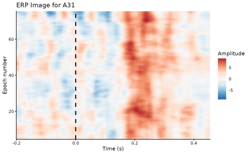 Plot Erp Difference Waves Plot Difference Eegutils - Perfect Abstract Picture - 4K