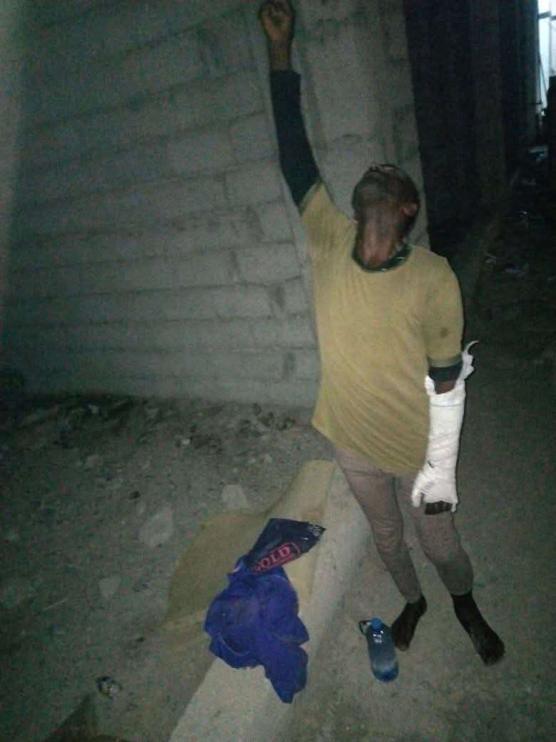 إصابة خطيرة لمهاجر إثيوبي في لحج بعد حادث مروري