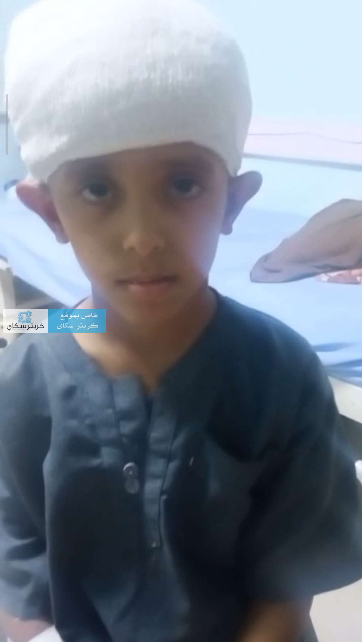 إنقاذ طفل من الموت بعد نزيف دماغي خطير