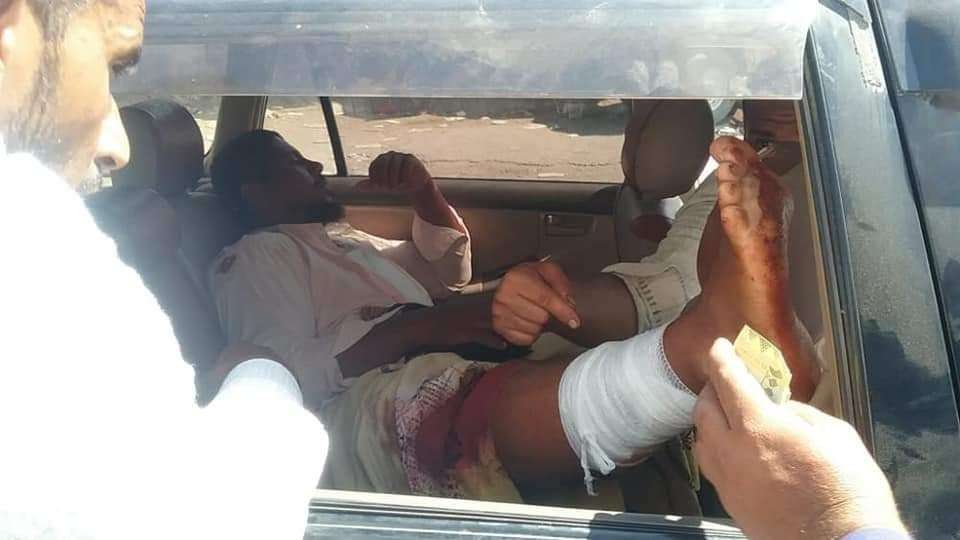 إصابة شخصين اثر إنفجار هز مدينة شقرة الساحلية بأبين (أسماء)