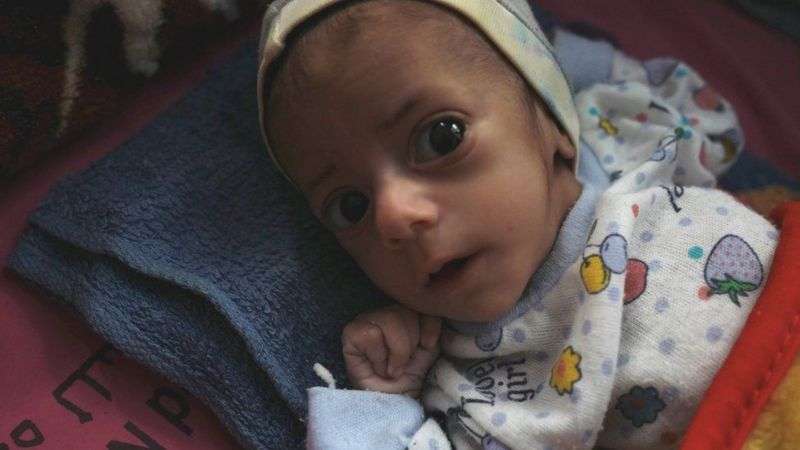 الحرب في اليمن: مدينة مأرب تعيش مأساة إنسانية في ظل حرب قذرة