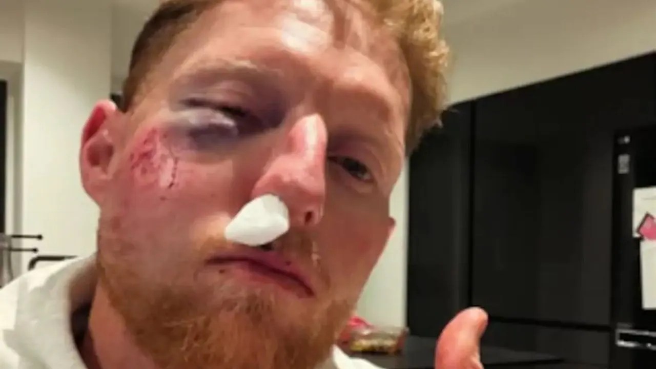 Ben Stokes traumatised after facial smash, vows helmet rule for all times