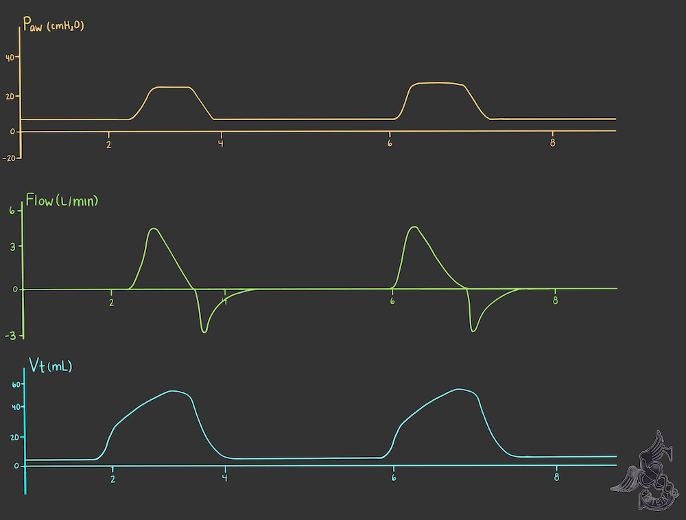 Riding the Waves: Ventilator Waveform Interpretation – CriticalCareNow