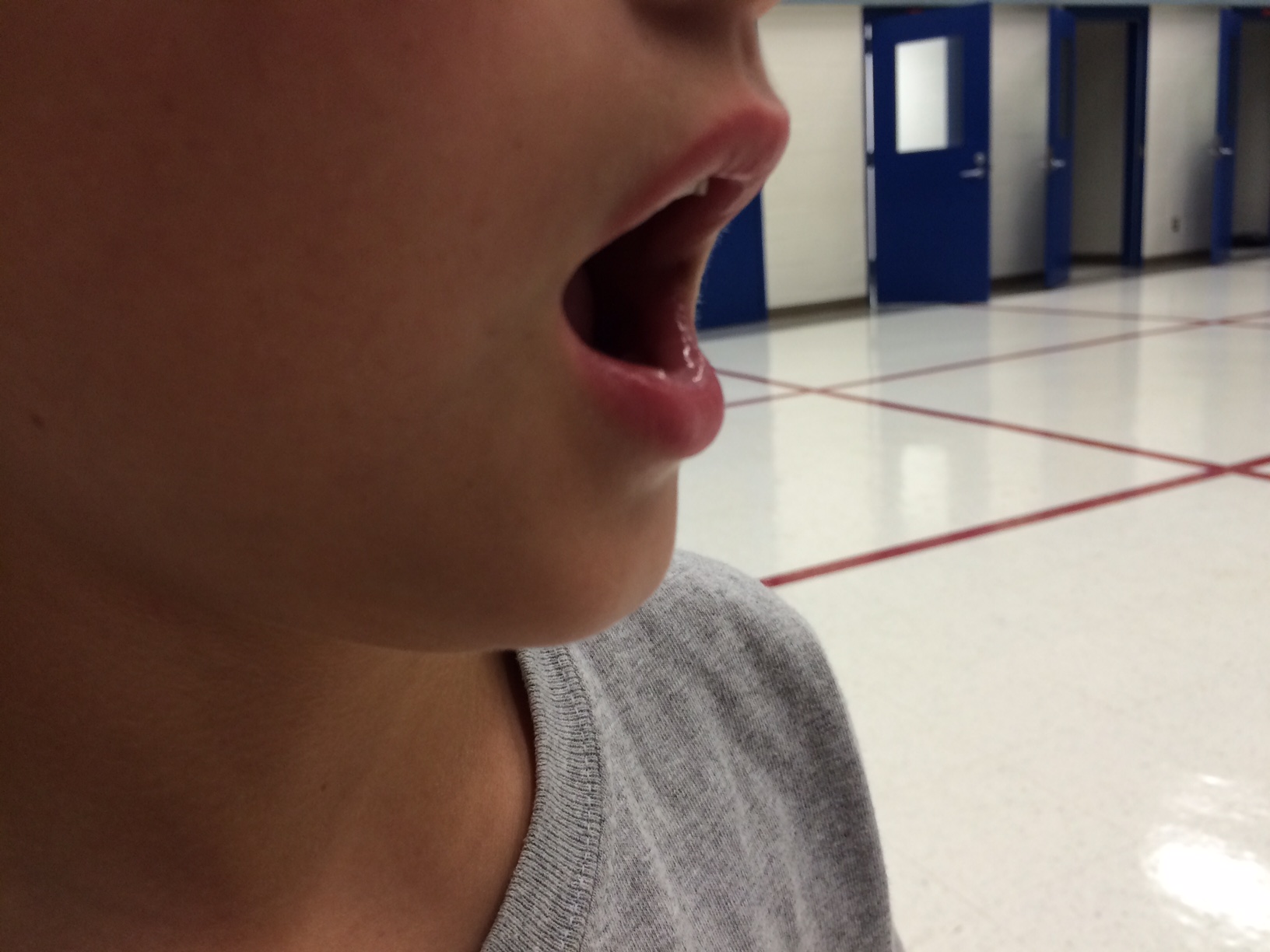 Clarinet Embouchure