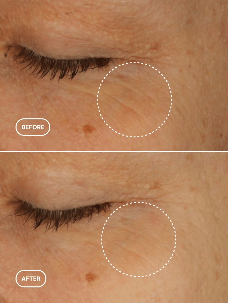 Renewal Eye Serum - Image 2
