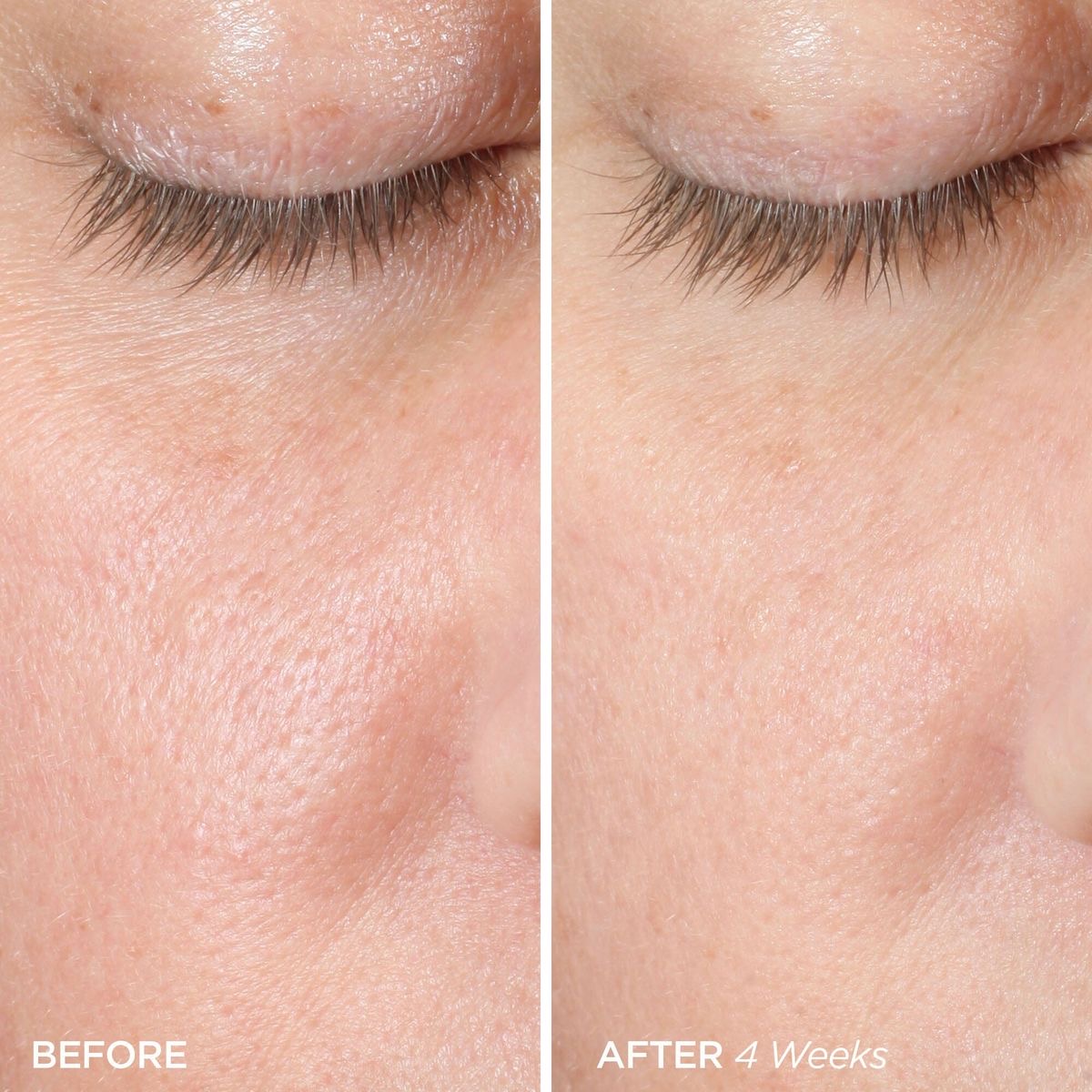AHA Peeling Concentrate - Image 3