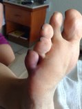 foot 2