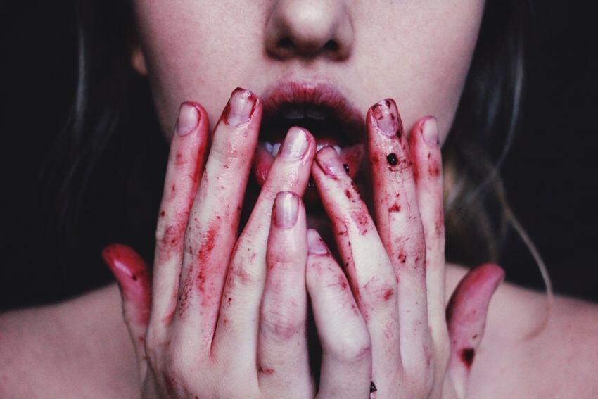 Xsn4fsmtyzaxjdgcqhhuo2m7vm - parabiosis: el costoso tratamiento con sangre para conseguir la eterna juventud