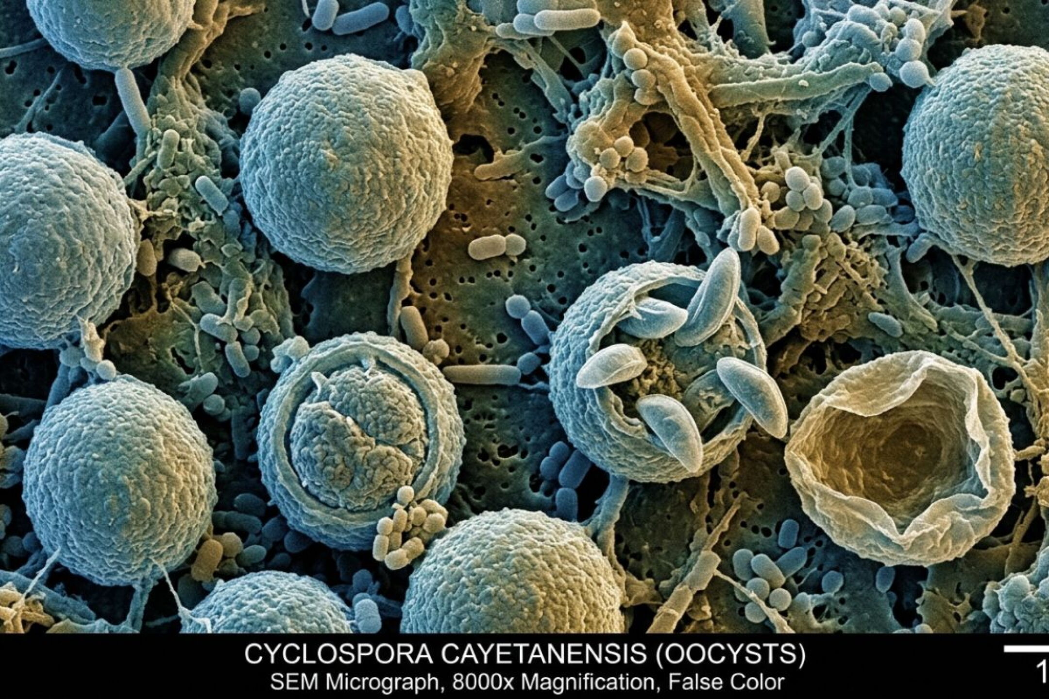 MÉXICO CONFIRMA 33 CASOS DE CICLOSPORIASIS Y NIEGA SER EL ORIGEN DEL BROTE INTERNACIONAL