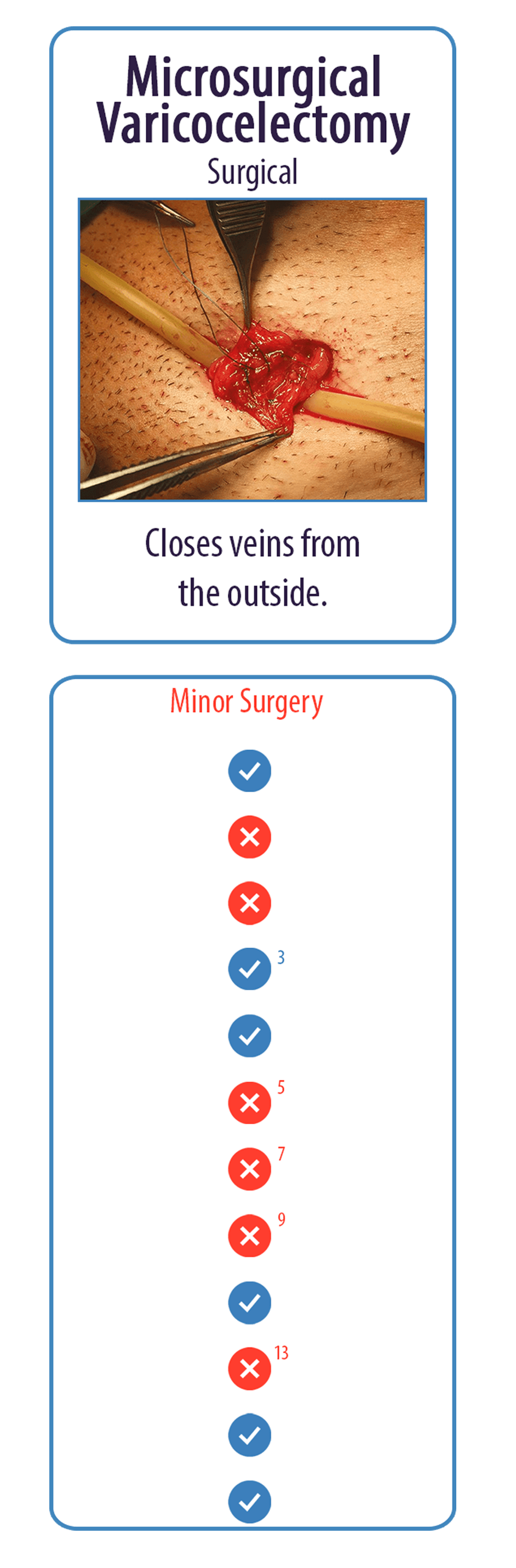 Microsurgical Varicocelectomy Surgical