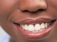 Dental problems are never any fun, but the good news is that most of them can be easily prevent. Comfort Dental - Lakewood, WA, 98499 - CyberCoupons