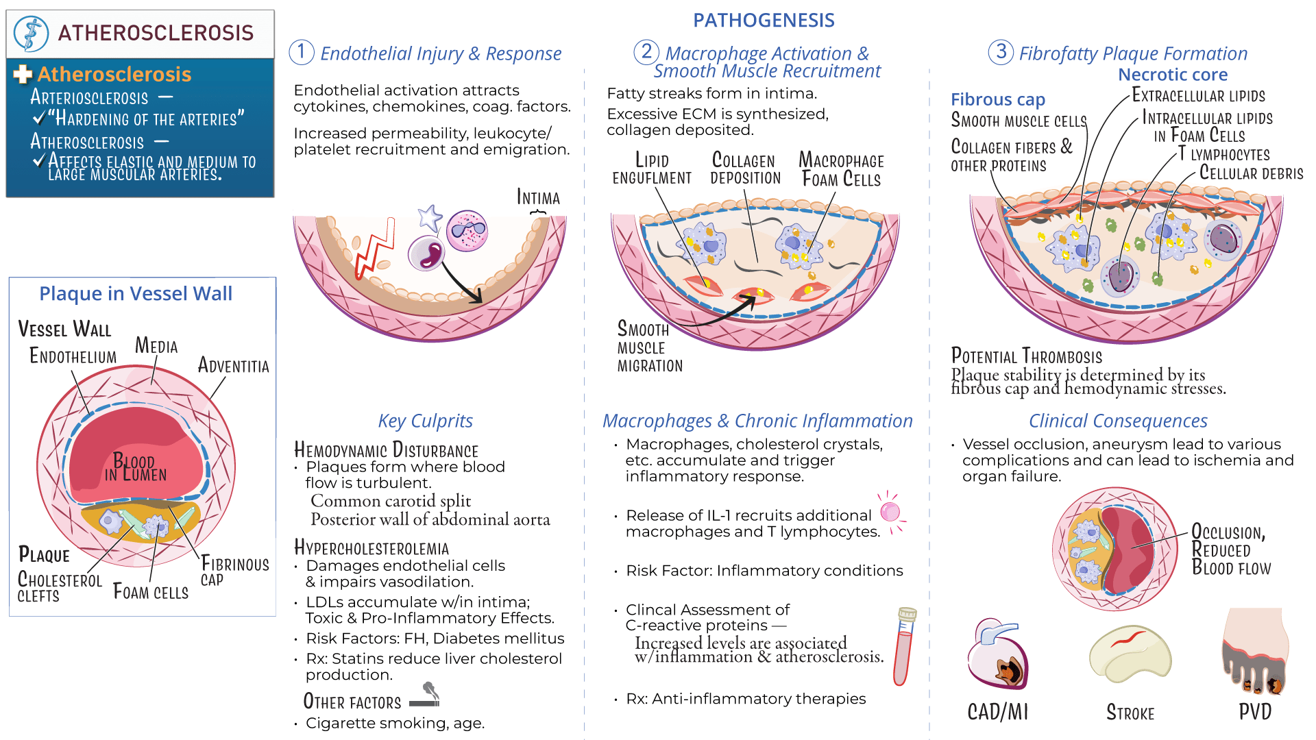 Advanced anatomy & physiology: atherosclerosis