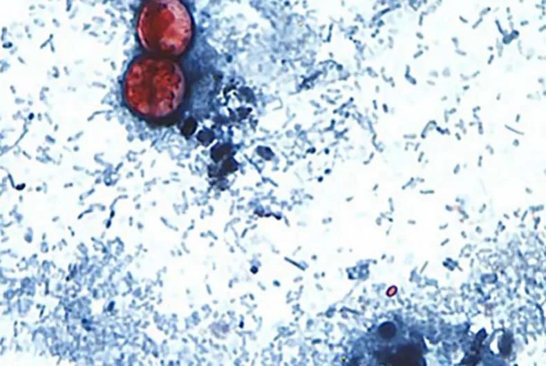 Cyclospora Outbreak Alert: 25+ Cases in Johnson County - What You Need to Know (2026)