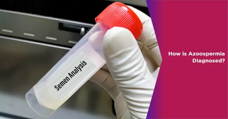 Aspermia Diagnosis | NOVA IVF
