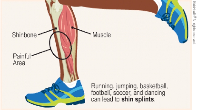 The spinalis muscle is a subsection of the erector spinae, which is a confluence of tendons and muscles. A Tell-All Guide To Shin Splints - FloTrack
