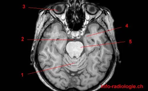 picture Brain Anatomy Mri Axial w radiology