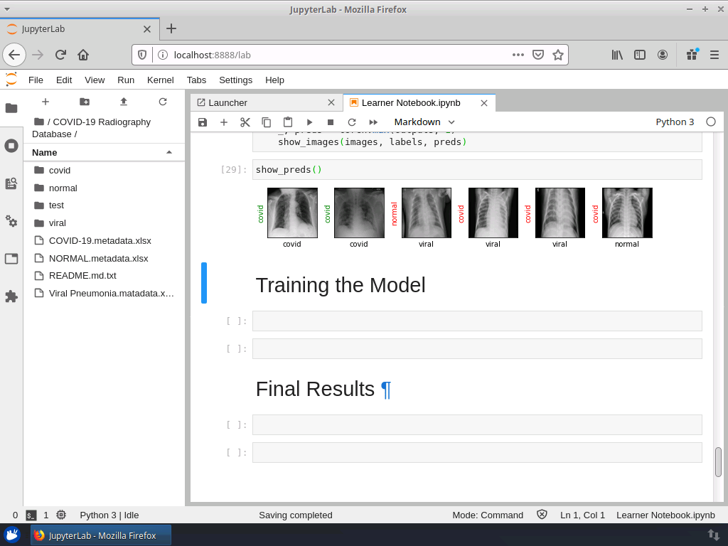 Detecting Covid 19 With Chest X Ray Using Pytorch - Gorgeous 8K Gradient Patterns | Free Download