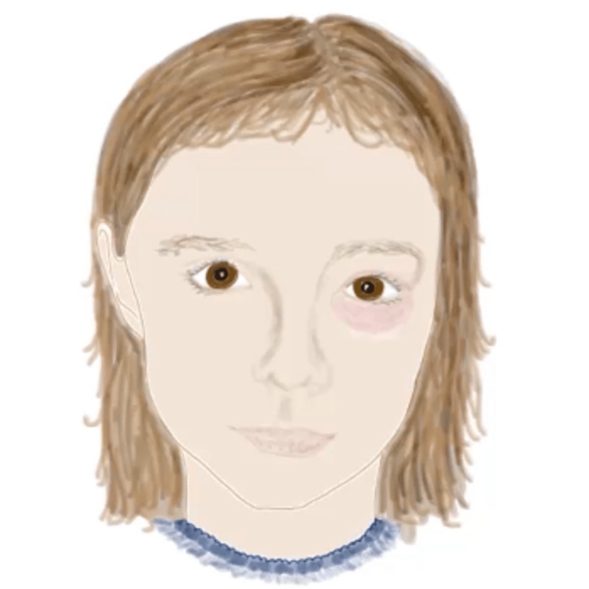 Blursed Disease Blursedcomments - Premium Nature Wallpaper Gallery - High Resolution