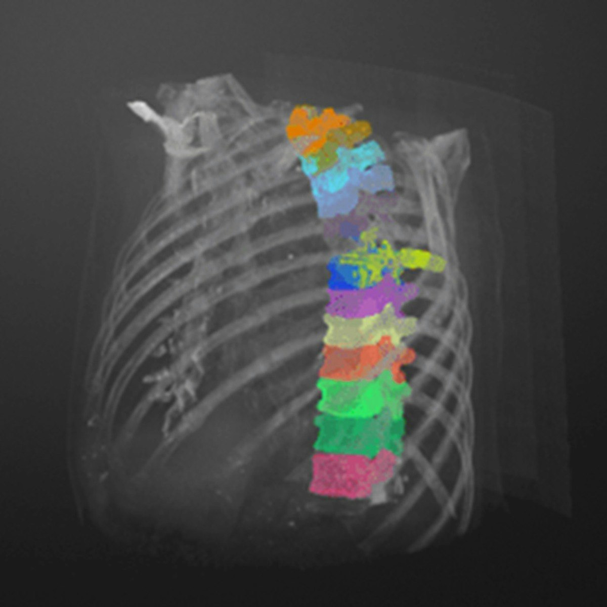 Medical Image Processing Course Manipalblog - Sunset Photo Collection - 8K Quality