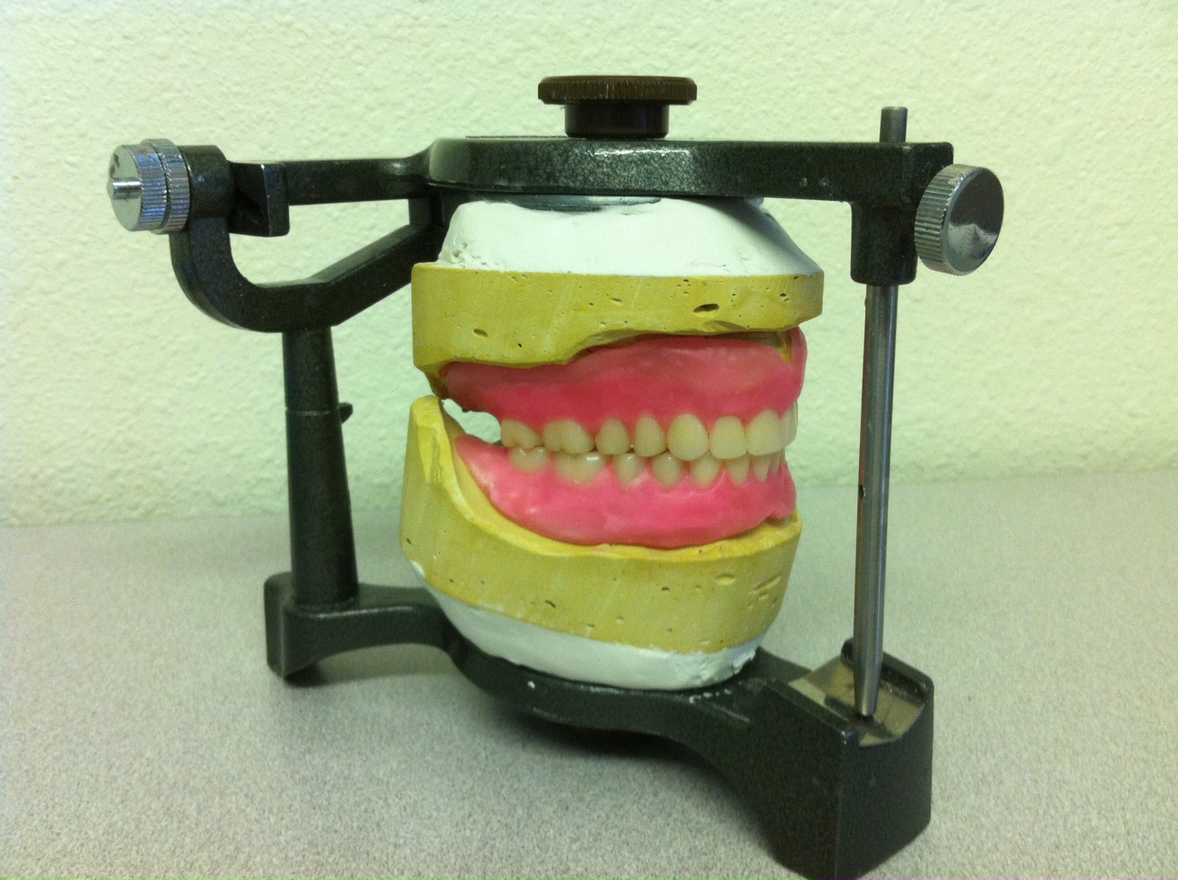 Conventional Dentures